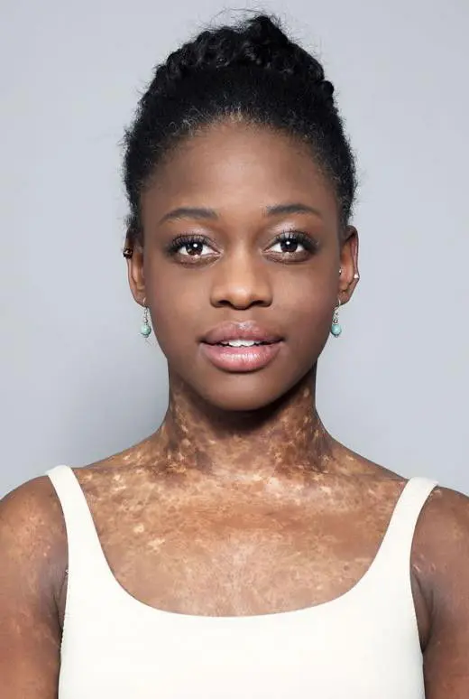 Michaela DePrince